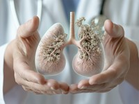 ¿Qué es la silicosis y cómo tratar este problema?
